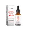 OUHOE TCA Acid Skin Peel Serum